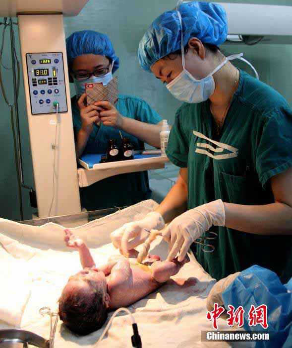 高清:四川地震高位截肢女孩产下2490克男婴